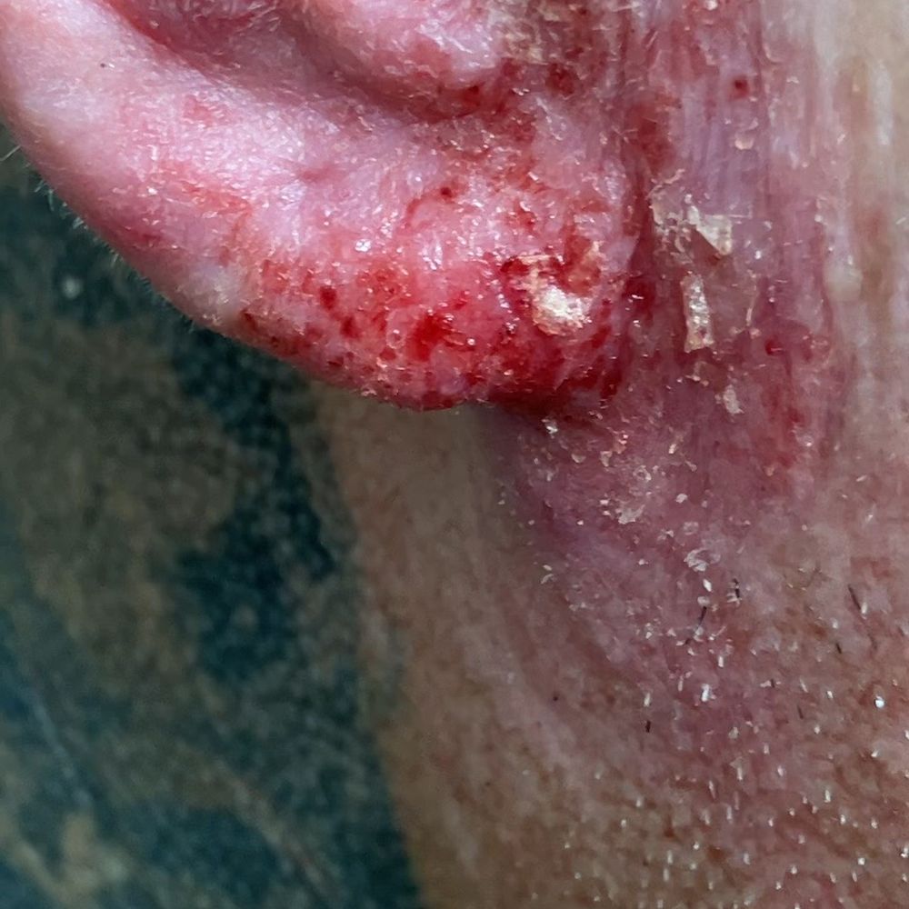 Regency Dermatology - Not a scratch - Dermatologists Near Me - Surprise, Arizona Regency Dermatology - Not a scratch - Dermatologists Near Me - Surprise, Arizona