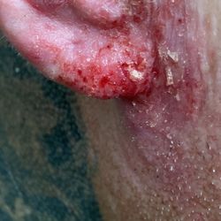 Regency Dermatology - Not a scratch