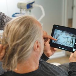 Northwestern Hair Restoration - Dr. Rawlani using our trichoscopy technology to map out a patient future hair loss pattern to plan for their hair restoration.
