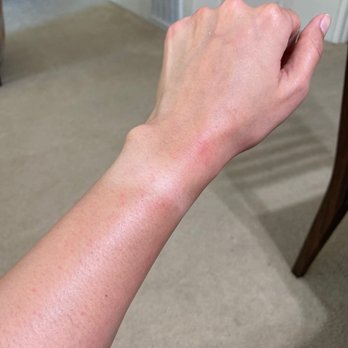 Starlight Beauty & Nail - My skin is sore after being pulled multiple times at the same place - Nail Salons Near Me - San Mateo, California Starlight Beauty & Nail - My skin is sore after being pulled multiple times at the same place - Nail Salons Near Me - San Mateo, California