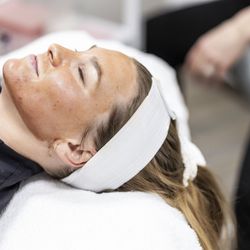 Facial Aesthetics - Facial Aesthetics Monument Colorado Chemical Peel