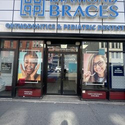 Diamond Braces