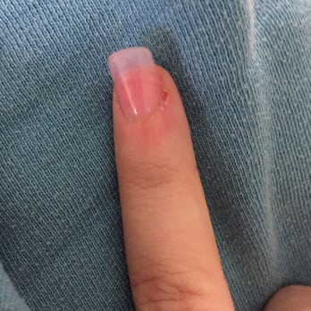 Best Nails - This cut was painful - Nail Salons Near Me - San Marcos, California Best Nails - This cut was painful - Nail Salons Near Me - San Marcos, California