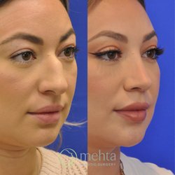 Mehta Plastic Surgery
