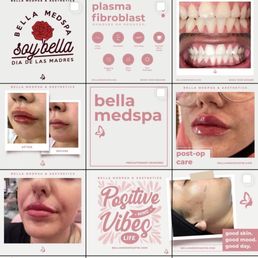 Follow them @Bella.Medspa on Instagram and Facebook Follow them @Bella.Medspa on Instagram and Facebook