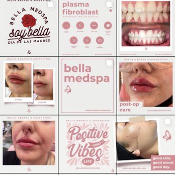 Bella Medspa And Aesthetics - Follow them @Bella.Medspa on Instagram and Facebook - Beauty & Spas Near Me Bella Medspa And Aesthetics - Follow them @Bella.Medspa on Instagram and Facebook - Beauty & Spas Near Me