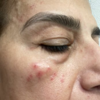 Baba Threading - Right side of face. - Threading Services Near Me - Costa Mesa, California Baba Threading - Right side of face. - Threading Services Near Me - Costa Mesa, California
