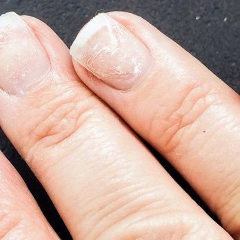 4 Seasons Nails and Spa - Right hand, and more acrylic remaining on my nails as well as damaged nails. - Nail Salons Near Me - Mesa, Arizona 4 Seasons Nails and Spa - Right hand, and more acrylic remaining on my nails as well as damaged nails. - Nail Salons Near Me - Mesa, Arizona