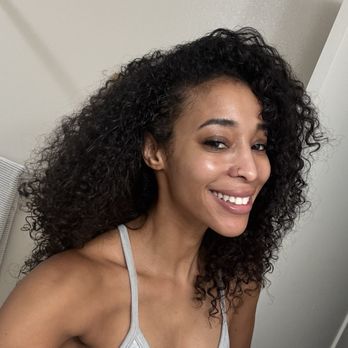 Derm by Erica - My skin as of July 2024. It has been clear for the past several months. - Skin Care Near Me - Culver City, California