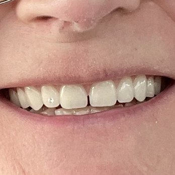 Creative Design Denture Clinic - They look so natural and feel amazing - Health & Medical Near Me - Wetaskiwin, Alberta Creative Design Denture Clinic - They look so natural and feel amazing - Health & Medical Near Me - Wetaskiwin, Alberta