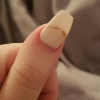 Stop 4 Nails - Look at that dent she put in on the thumb. - Nail Salons Near Me - Bellevue, Washington Stop 4 Nails - Look at that dent she put in on the thumb. - Nail Salons Near Me - Bellevue, Washington
