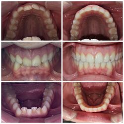 Crownsville Dental & Wellness Solutions