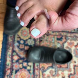 Infection on toes Infection on toes