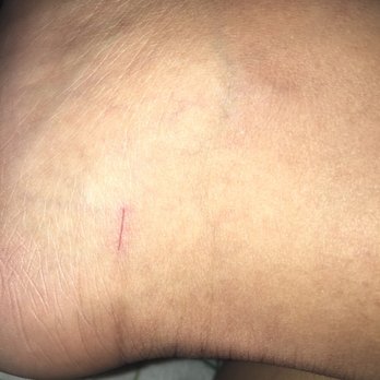 Dayus Nail Spa - Cut near my ankle! - Nail Salons Near Me - Redondo Beach, California
