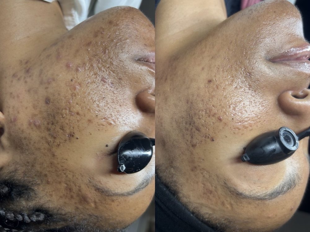 The Juvinex Room Logo