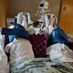 Shelbourne Knee Center - Post surgery in the hospital room. Lower legs in the CPM and knees encased in the cyrocuff.