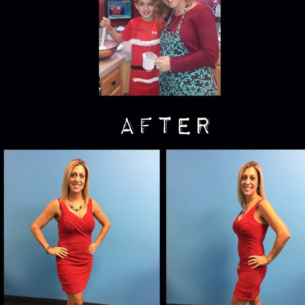 semaglutide injection west palm beach Semaglutide: Weight-loss wonder drug sparks 'Ozempic Babies' phenomenon West Palm Beach Weight Loss
