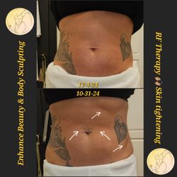 Enhance Beauty & Body Sculpting by Elizabeth