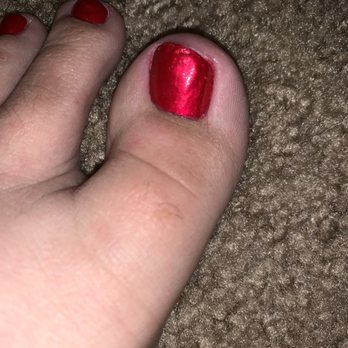 Evergreen Nails & Spa - so much polish coated on my toe nail to try to fix crap job that it won't dry - Nail Salons Near Me - Glendale, Arizona