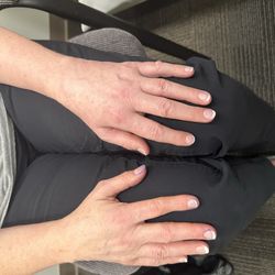 Advanced Pain Centers of Alaska - Comparison photos of right (non affected side) with left (affected side). Less swollen/less pain after ganglion block.
