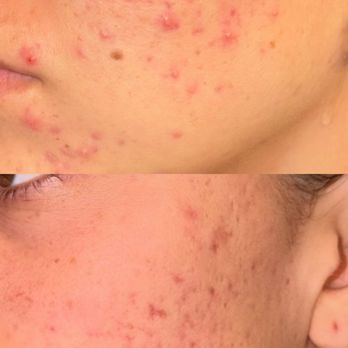 Face Haven Aesthetics - Skin Care Near Me - La Jolla, California Face Haven Aesthetics - Skin Care Near Me - La Jolla, California