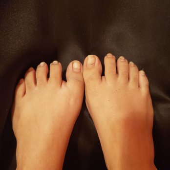 Rio Nail Bar & Lash - How my toes looked when I took my polish off after my 1st/ only visit. I didn't ask for anything fancy, just regular polish - Eyelash Service Near Me - Schertz, Texas