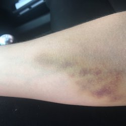 QUEST DIAGNOSTICS - 25 Photos & 47 Reviews - 10230 Artesia Blvd