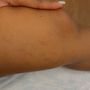 Photo of Metro Vein Centers - Glastonbury