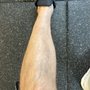 Elmore Medical Vein and Laser Treatment Center