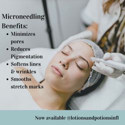 Lotions and Potions - Microneedling has so many benefits. Let's schedule you today for your consultation.