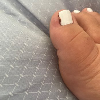 Me' N You Nails - this is now 2 says after nail appointment. I have been cleaning and treating it and now it's starting to pus - Nail Salons Near Me - Los Angeles, California