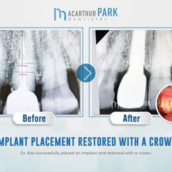 MacArthur Park Dentistry - MacArthur Park Dentistry Emergency, Invisalign, Implant | Call: (972)831-9600