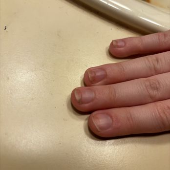 Lavish Nail And Spa - Nail infection I developed after going to this nail salon - Nail Salons Near Me - Panama City, Florida Lavish Nail And Spa - Nail infection I developed after going to this nail salon - Nail Salons Near Me - Panama City, Florida