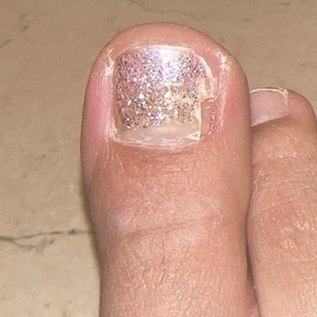 Gloss Nails Studio - Nail coming off due to fungus - Nail Salons Near Me - Santa Clarita, California Gloss Nails Studio - Nail coming off due to fungus - Nail Salons Near Me - Santa Clarita, California