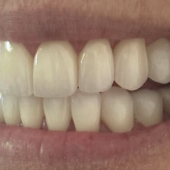 Boca Raton Cosmetic Dentist - Smile makeover - Orthodontists Near Me - Boca Raton, Florida Boca Raton Cosmetic Dentist - Smile makeover - Orthodontists Near Me - Boca Raton, Florida