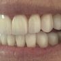 Boca Raton Cosmetic Dentist