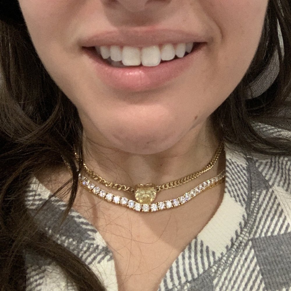 Gregory Albert's Optimization Centre - Crooked smile - Plastic Surgeons Near Me - Boca Raton, Florida