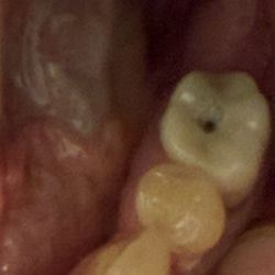 Dowiatt Dental - Craig Dowiatt, DDS - Failed dentistry