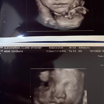 3DBabyVu - Ultrasound Imaging Centers Near Me - Pleasanton, California