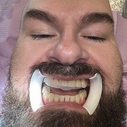 Advanced Laser Dentistry