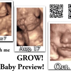 Baby Preview