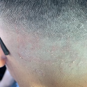 Sun City Barber Shop - His blades did this to my sons back hair - Barbers Near Me - Sun City, California Sun City Barber Shop - His blades did this to my sons back hair - Barbers Near Me - Sun City, California