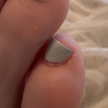 Polish Me Nail Spa - Other pinky toe how nail should be - Nail Salons Near Me - Jersey City, New Jersey Polish Me Nail Spa - Other pinky toe how nail should be - Nail Salons Near Me - Jersey City, New Jersey