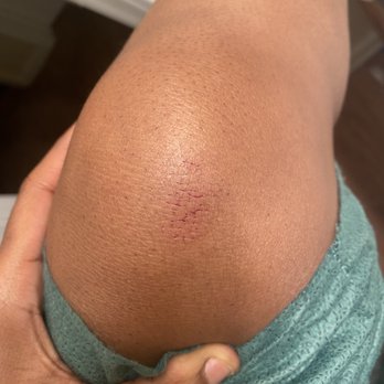 Duke Regional Hospital - this is when i was forced on my stomach for them to force a shot in my arm. - Hospitals Near Me - Durham, North Carolina