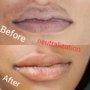 Photo of Lara Permanent Makeup