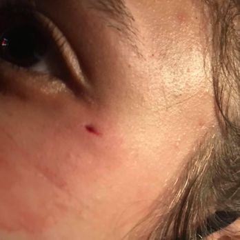 Pinstack - Injury sustained at Pinstacks March 2, 2021 - Bowling Near Me - Austin, Texas Pinstack - Injury sustained at Pinstacks March 2, 2021 - Bowling Near Me - Austin, Texas