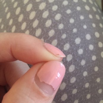 The Nail Stop - Chipped index finger after 1 day and huge missing piece on thumb after 1 week. iGel Match gel polish. - Nail Salons Near Me - Durham, North Carolina
