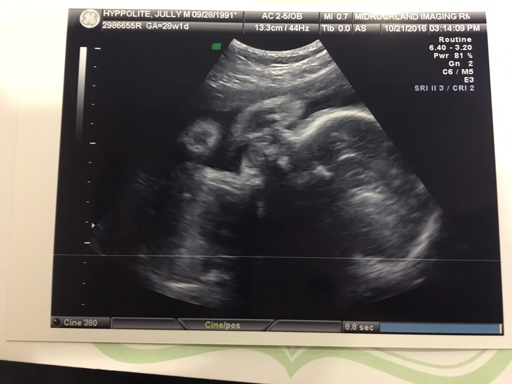 Hudson Valley Radiology Associates Updated availability 18 Reviews