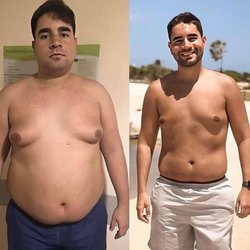 Clinica Ideal Harwin - 5 month body change
