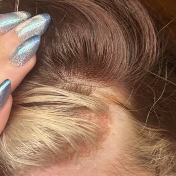 Ardor Salon - chemical burns on my scalp - Hair Salons Near Me - Bellingham, Washington